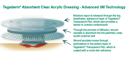 3M Tegaderm Absorbent Clear Acrylic Dressings
