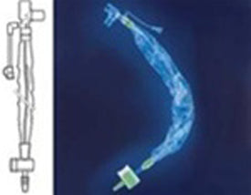 Kimberly Clark Neonatal And Pediatric Trach Care Elbow