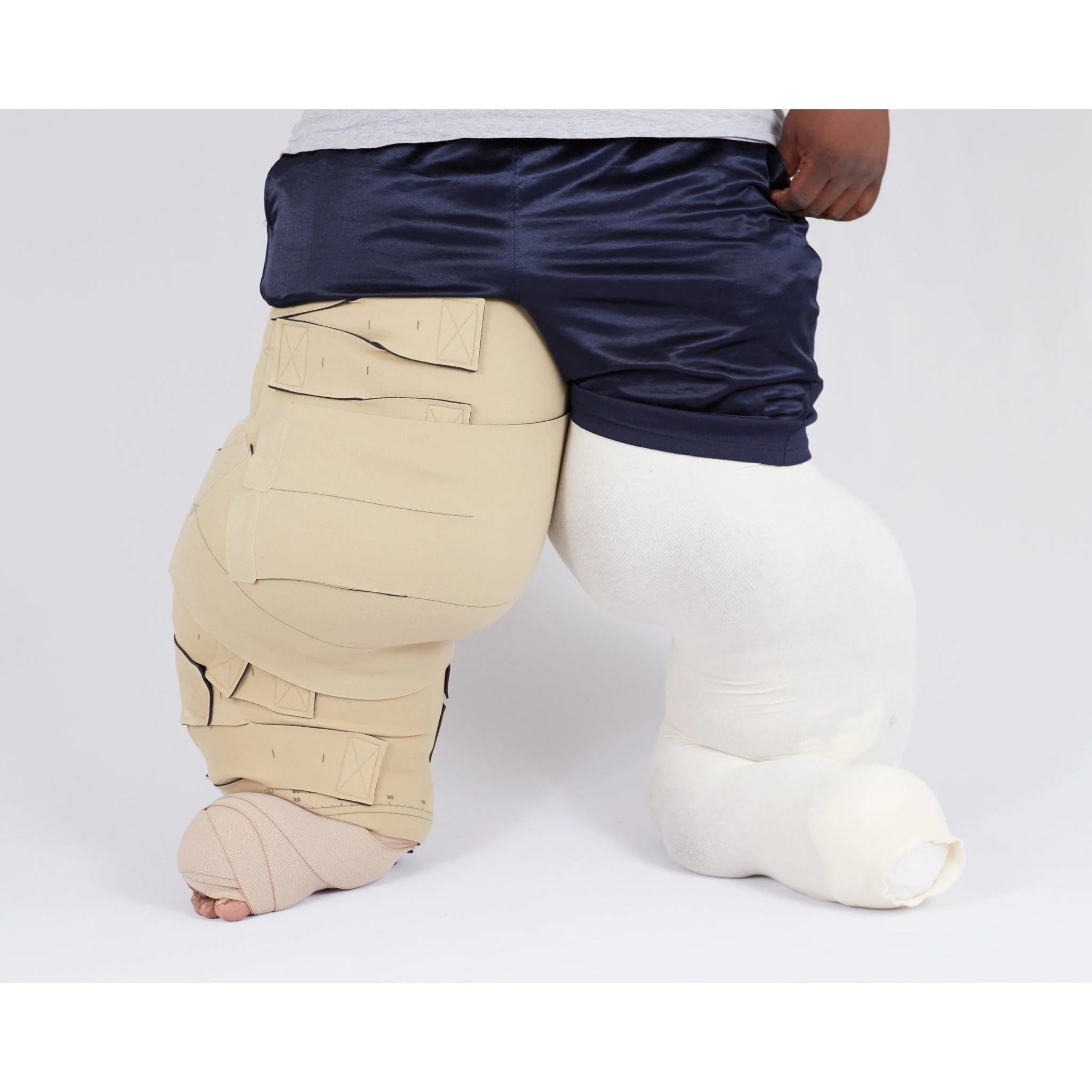medi circaid Reduction Kit Lobe | Modular Lymphedema Wrap | A6584